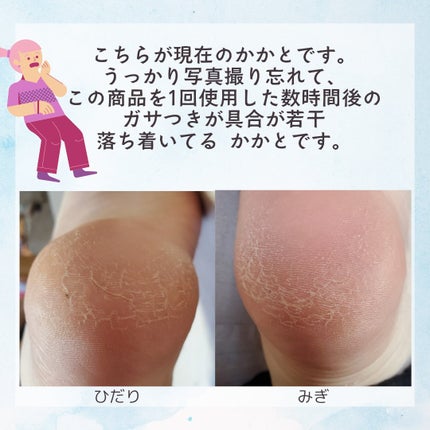 ぺろてぃ on LIPS 「本日の購入品紹介👣/ダイソーゲルかかとソックス税込み220円商..」(4枚目)
