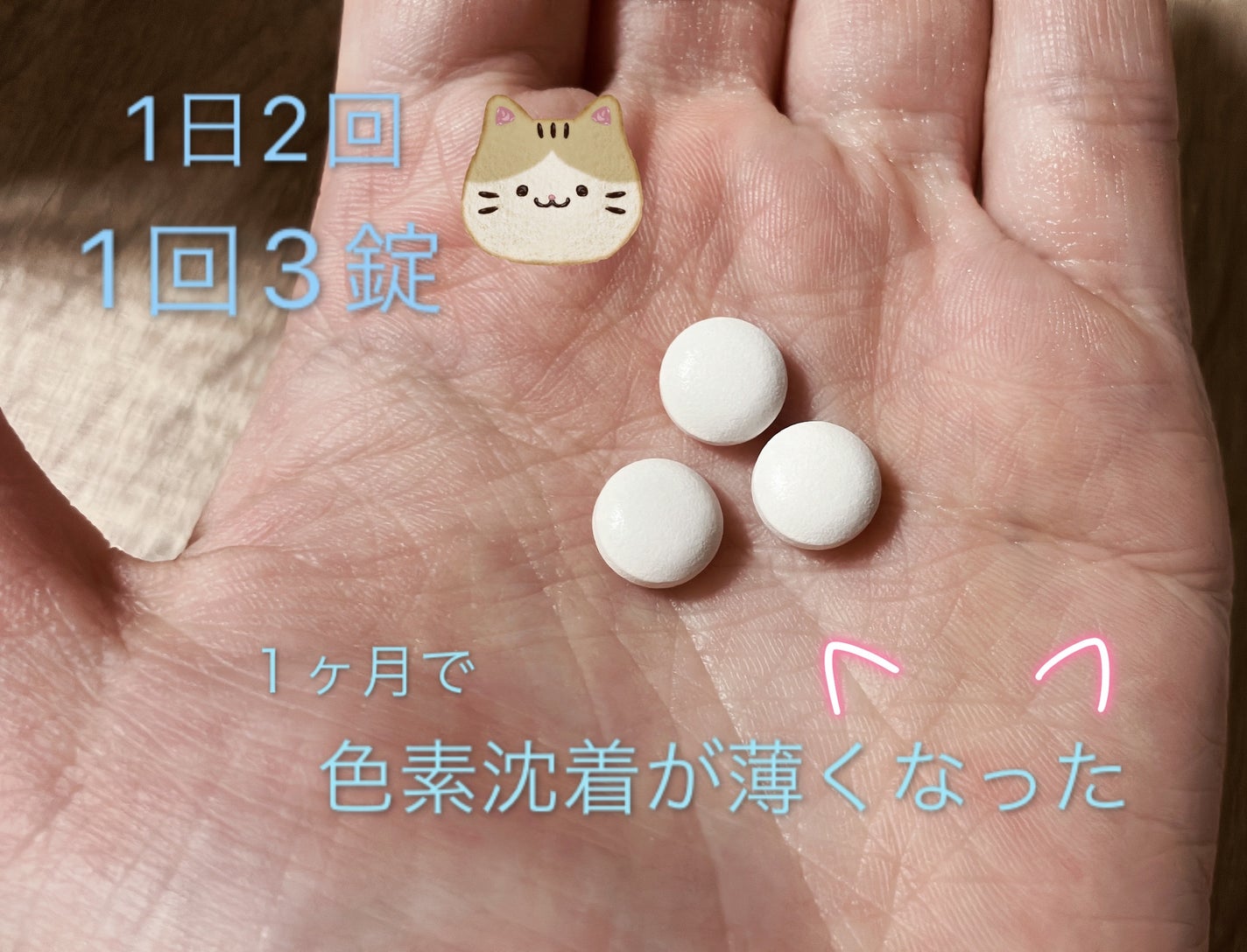 キュアティホワイトII(医薬品)/S SELECT/その他を使ったクチコミ(3枚目)