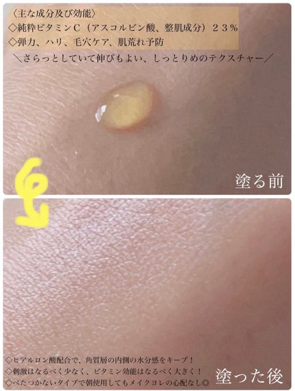 RXザ・ビタミンC23セラム/COSRX/美容液を使ったクチコミ(2枚目)