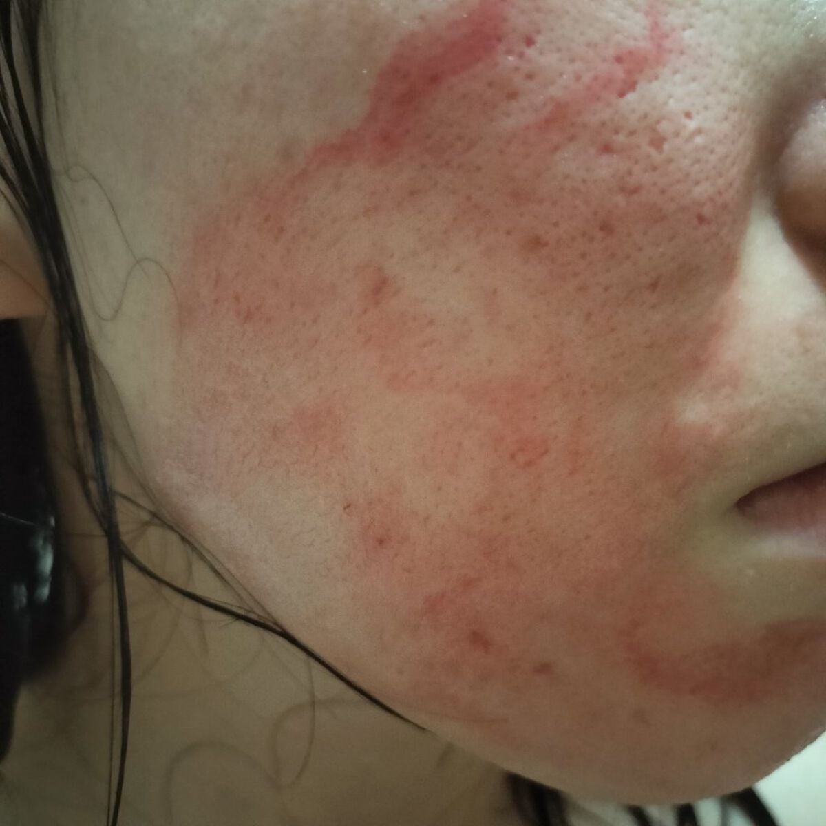 ビオオイル アルガンオイル/Melvita/フェイスオイルを使ったクチコミ(2枚目)