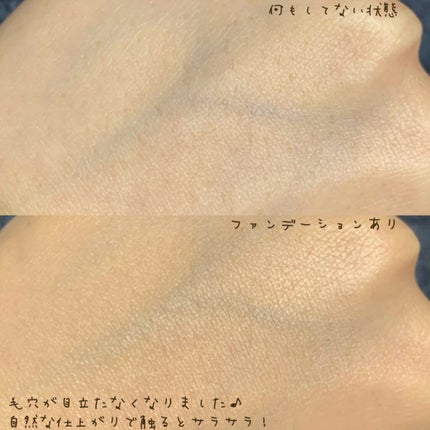 プロフィニッシュファンデーション 特製セット Ⅰ/インテグレート/メイクアップキットを使ったクチコミ(2枚目)