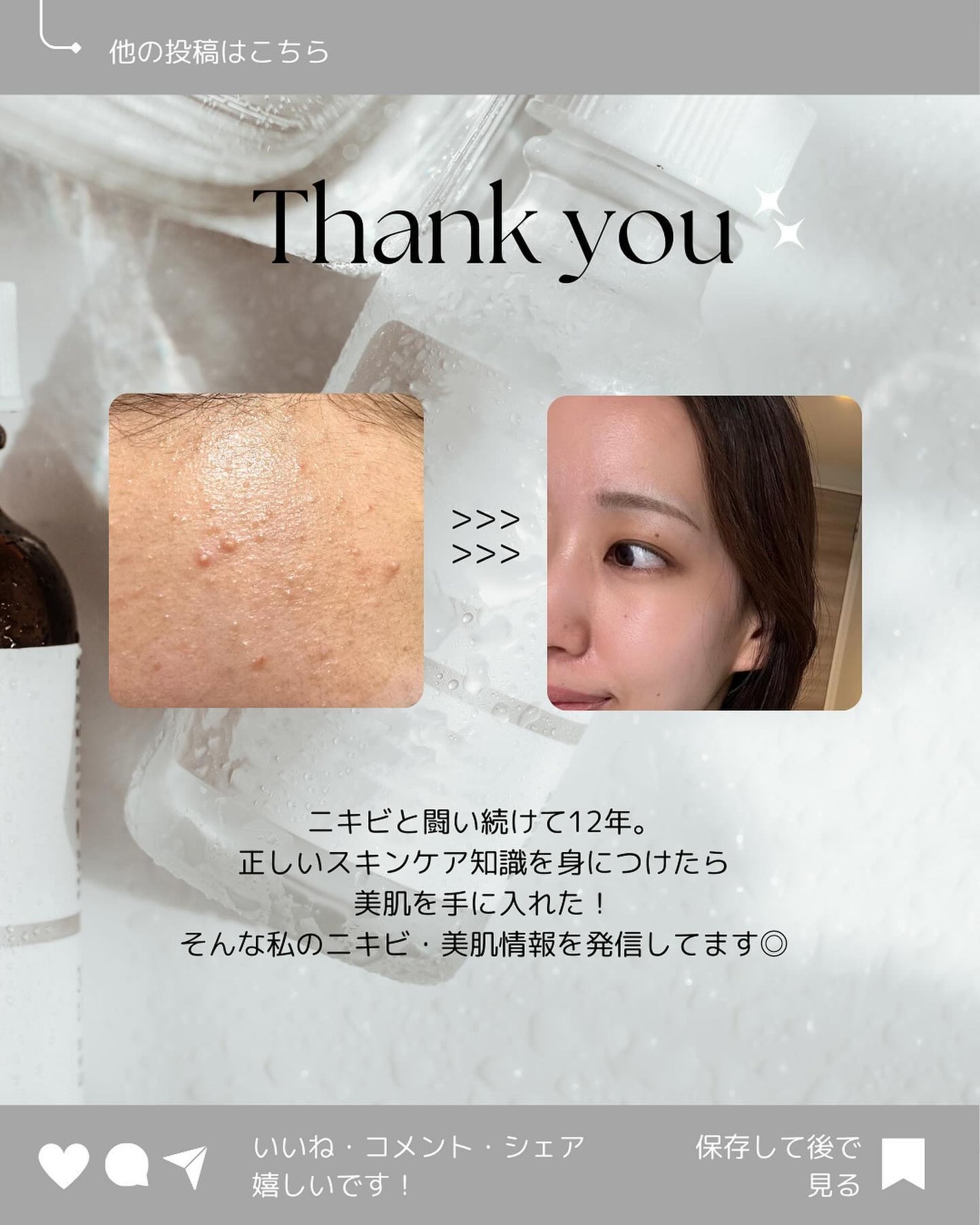 荒川七菜美 on LIPS 「ニキビ肌を卒業する方法🎓→@skin.tamagoどうも、たま..」(7枚目)