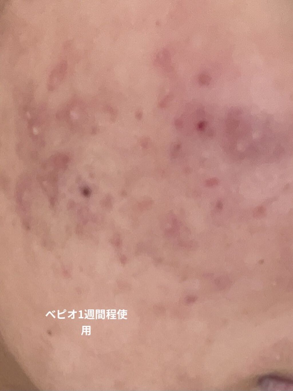 ドクダミ 77 スージングトナー/Anua/化粧水を使ったクチコミ（2枚目）