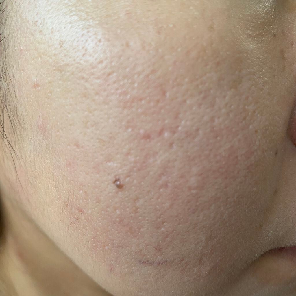 カラーグローファンデーション/sirocos/クリーム・エマルジョンファンデーションを使ったクチコミ(7枚目)