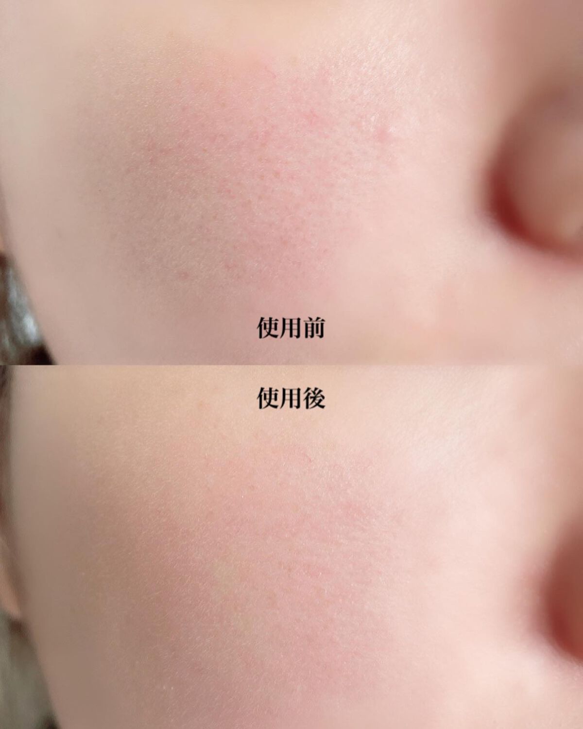 エイシカ365 ブレミッシュカーミングセラム/AESTURA/美容液を使ったクチコミ(6枚目)