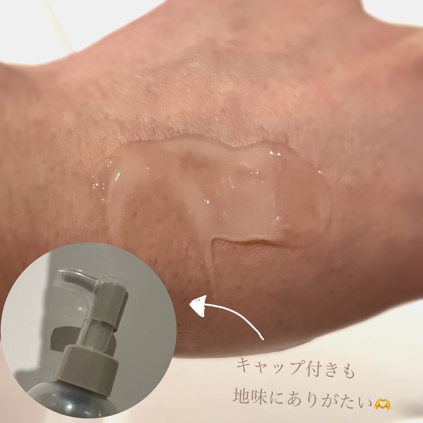メディプラスゲル/メディプラス/オールインワン化粧品を使ったクチコミ(3枚目)