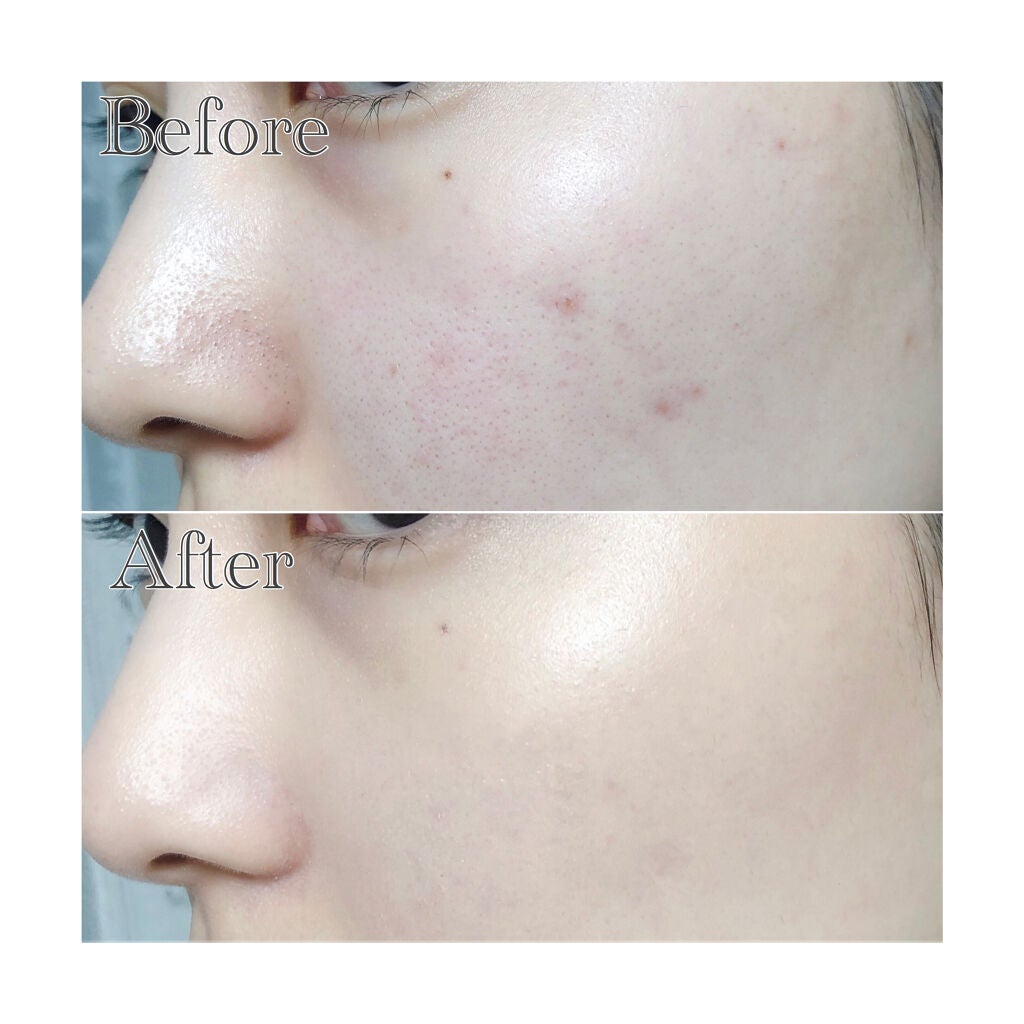 ミネラルグロウスキンクッション/エトヴォス/クッションファンデーションを使ったクチコミ(4枚目)