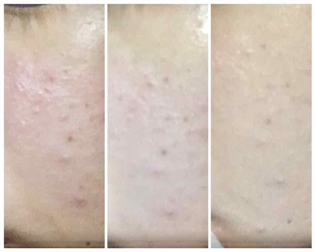 ダブルラスティング セラムファンデーション サンド/ETUDE/リキッドファンデーションを使ったクチコミ（2枚目）