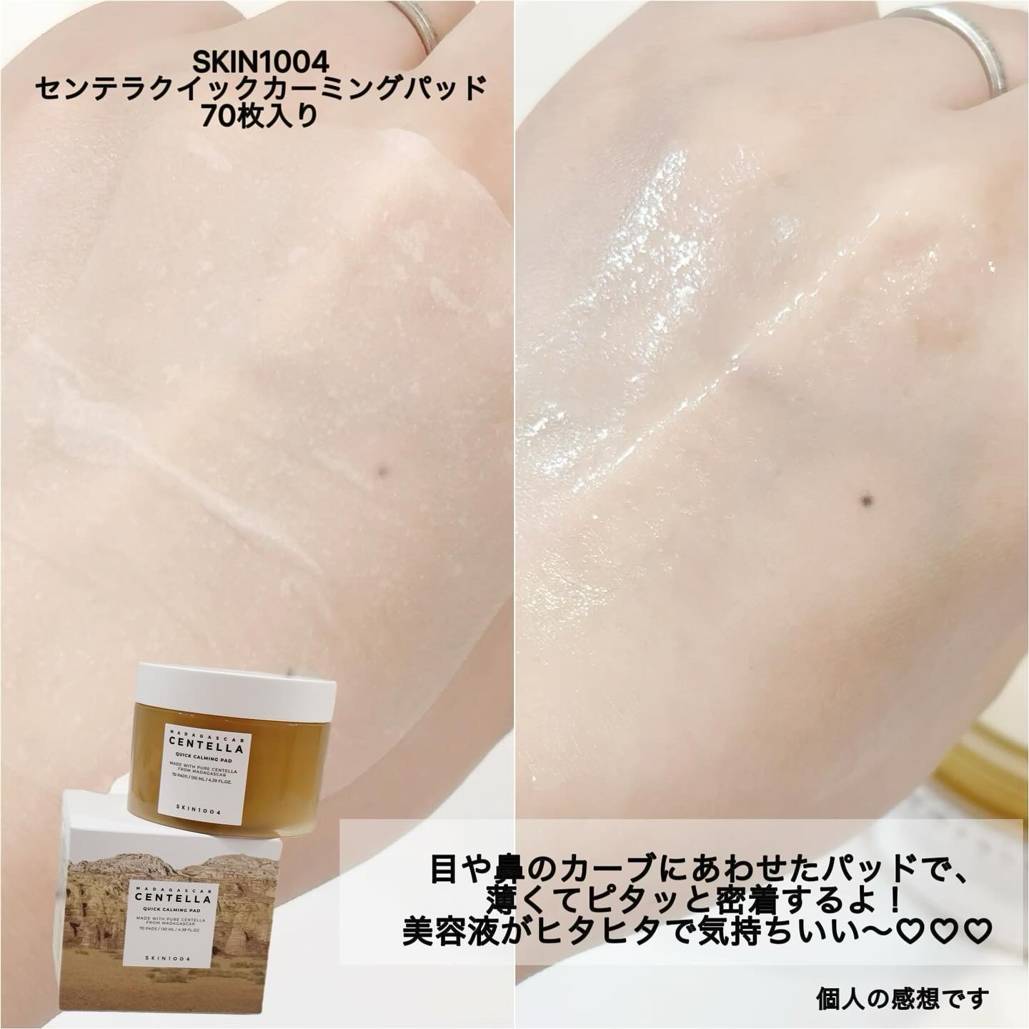 センテラ クイックカーミングパッド/SKIN1004/トナーパッドを使ったクチコミ（3枚目）