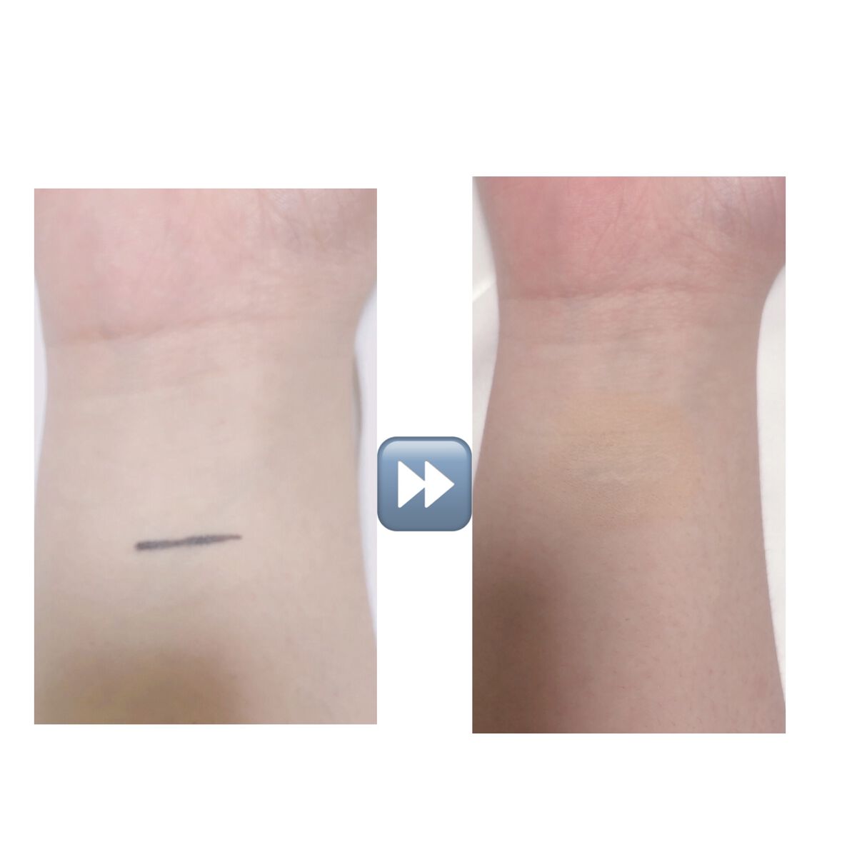 タトゥーウォータープルーフスカーコンシーラー/フォレンコス/リキッドコンシーラーを使ったクチコミ（2枚目）