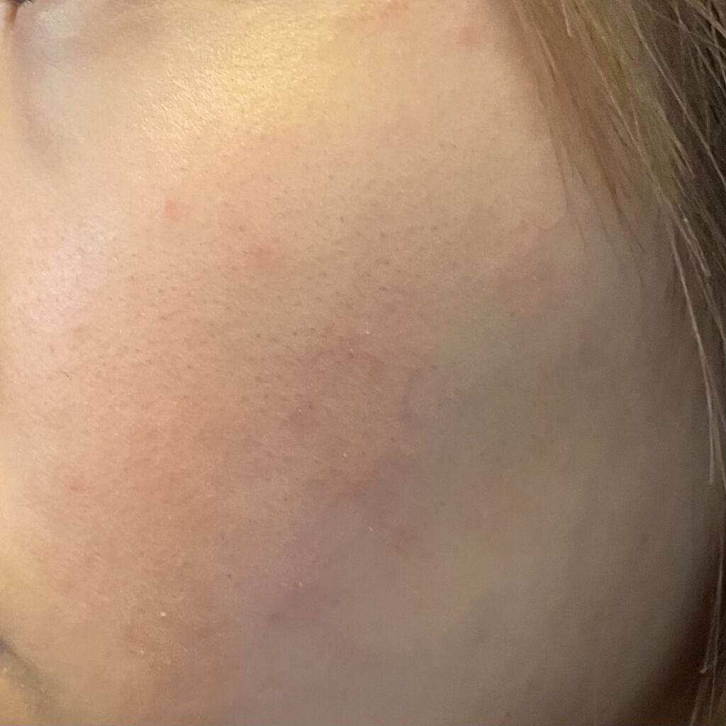 薬用固形パウダー/ピジョン/ボディパウダーを使ったクチコミ（3枚目）