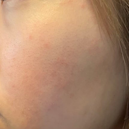 薬用固形パウダー/ピジョン/ボディパウダーを使ったクチコミ(3枚目)