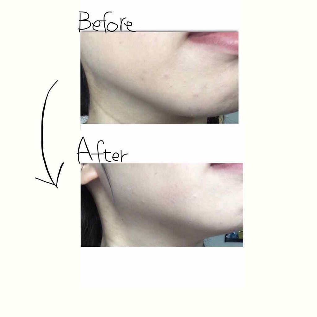 ラディアントクリーミーコンシーラー/NARS/リキッドコンシーラーを使ったクチコミ（3枚目）