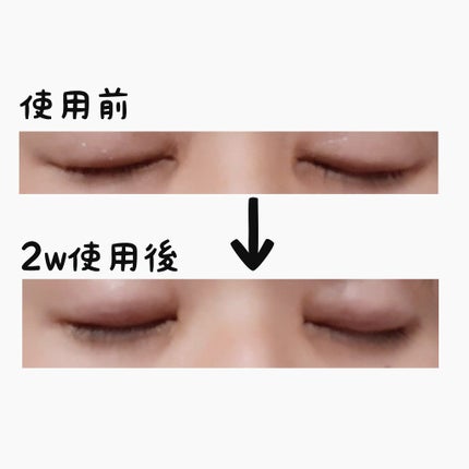 スカルプDボーテ ピュアフリーアイラッシュセラム プレミアムクイーン/アンファー(スカルプD)/まつげ美容液を使ったクチコミ(3枚目)