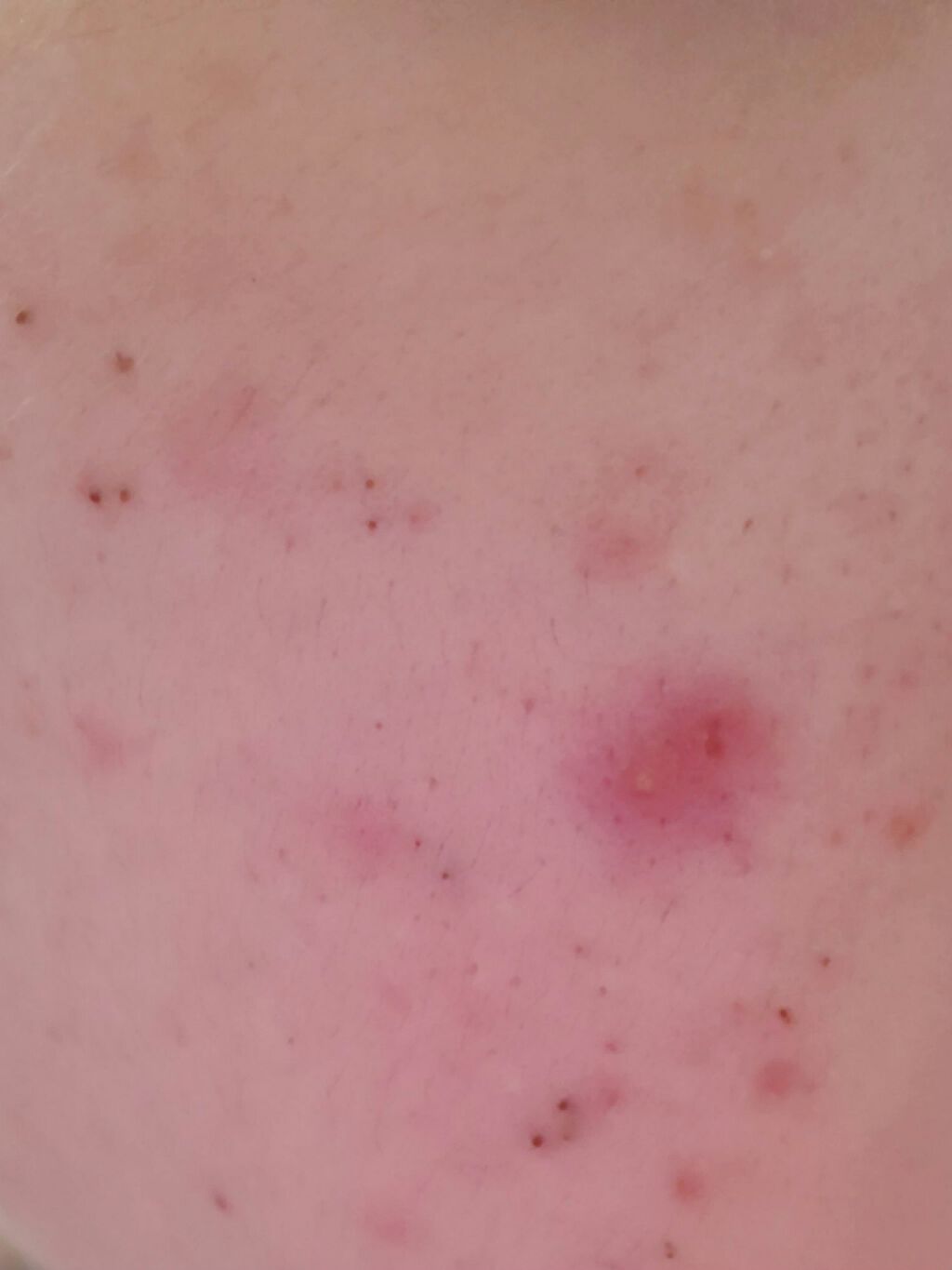 クリアトライアルセット M(しっとりタイプ)/オルビス/トライアルキットを使ったクチコミ(2枚目)