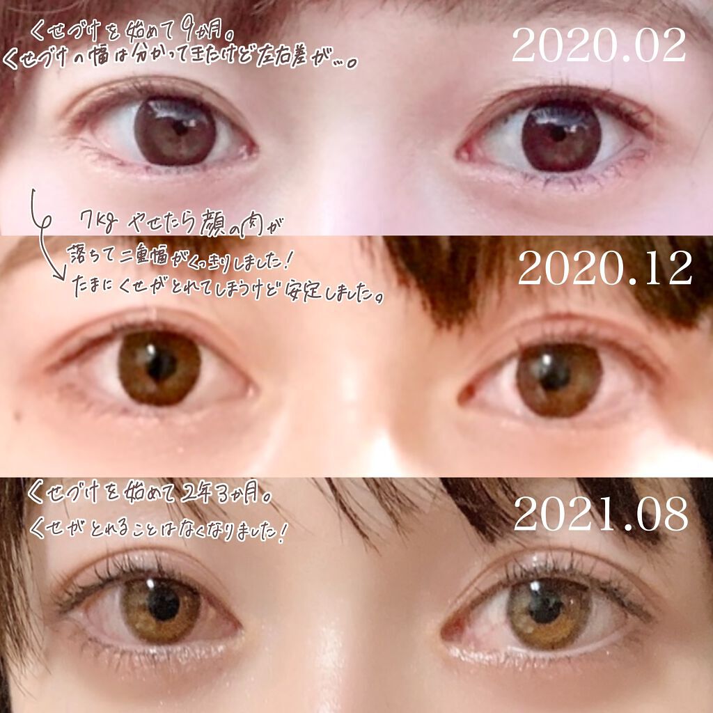 tobibi on LIPS 「2年半で目元はここまで垢抜けられる!/私の二重幅の広げ方とくせ..」(4枚目)