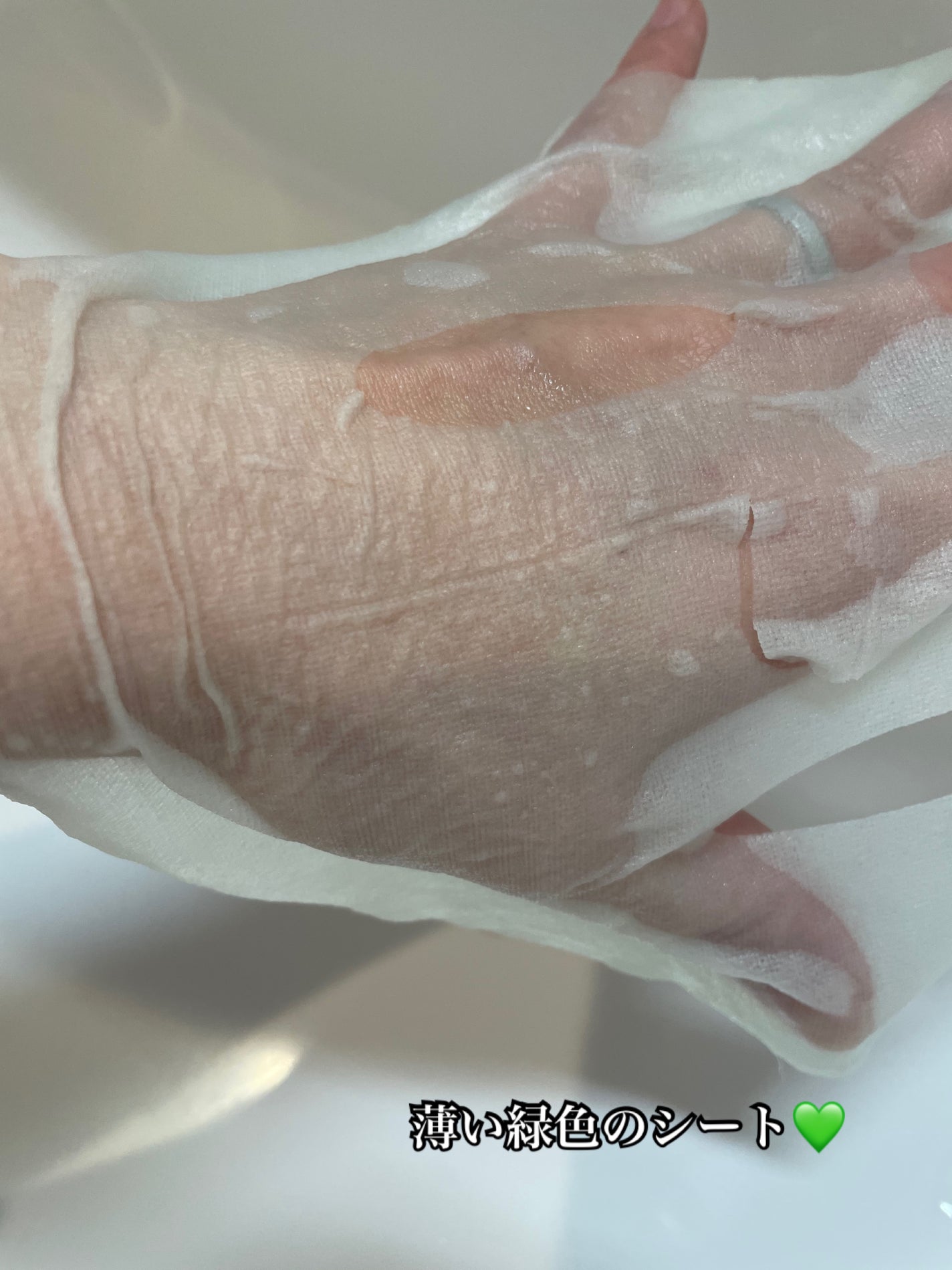 アゼライン酸15 インテンスカーミングセラムインマスク/Anua/シートマスク・パックを使ったクチコミ(3枚目)