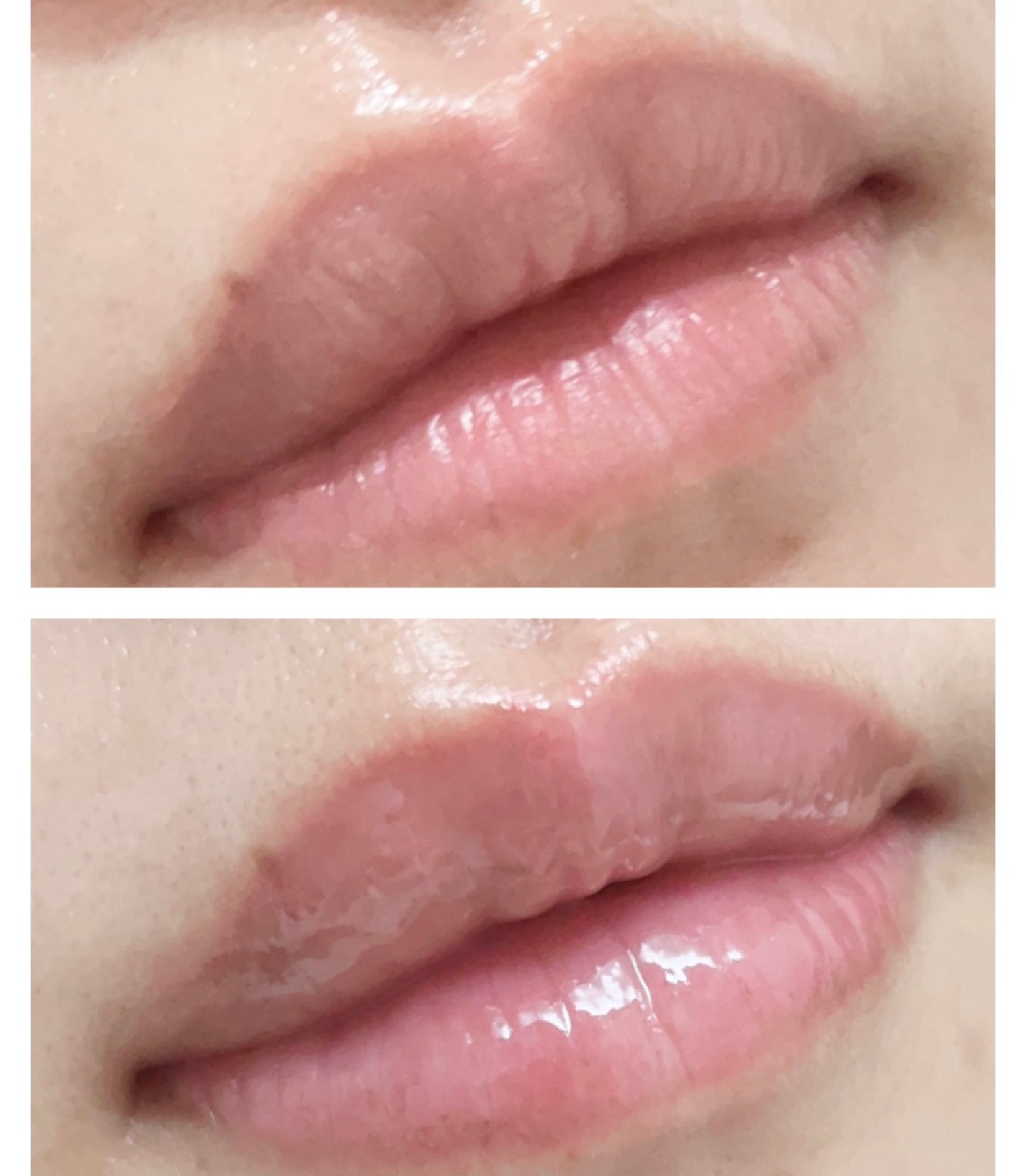 キューミ―ボムショットリッププランパー/AGARISM/リッププランパーを使ったクチコミ(6枚目)