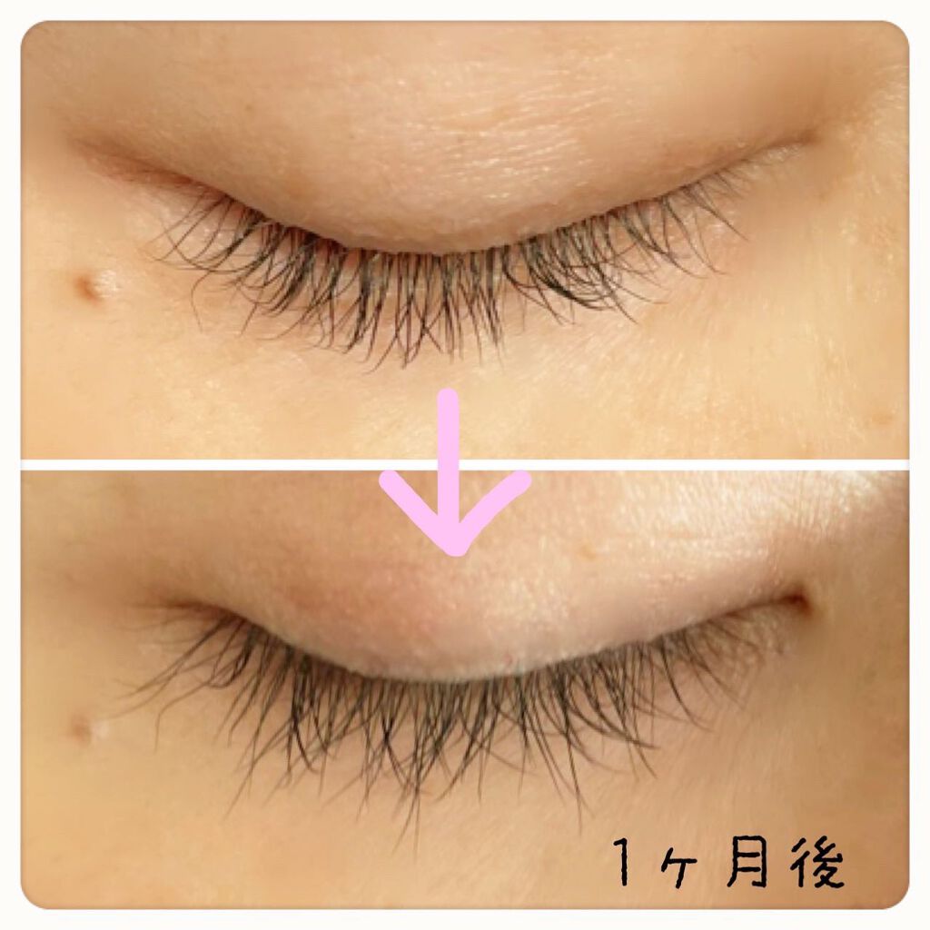 エグータム/アルマダスタイル/まつげ美容液を使ったクチコミ（2枚目）