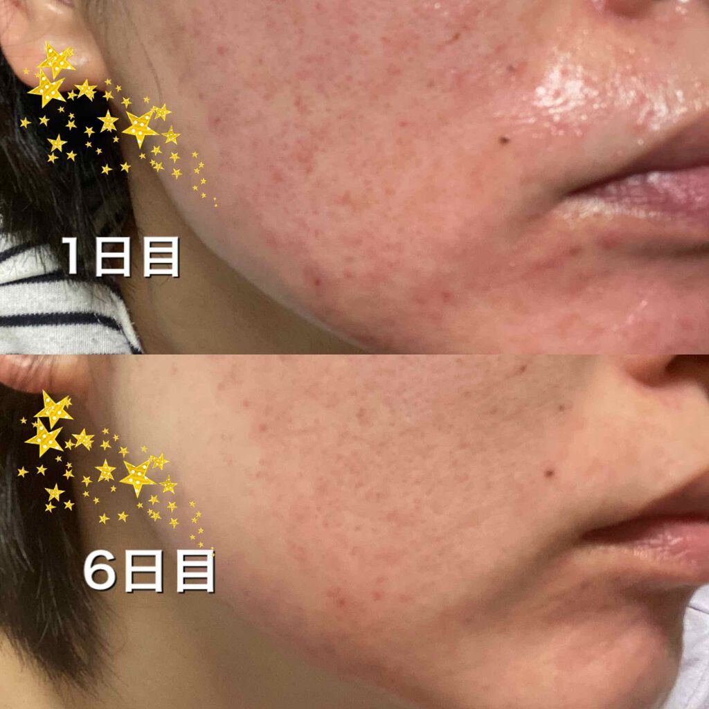 amin on LIPS 「こんばんは!皆さん今日も一日お疲れ様でした!入学式の方は無事に..」(2枚目)