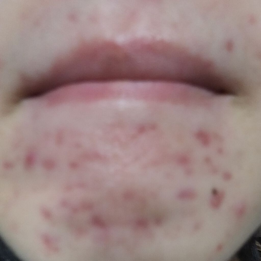 潤い化粧水/ももぷり/化粧水を使ったクチコミ(2枚目)