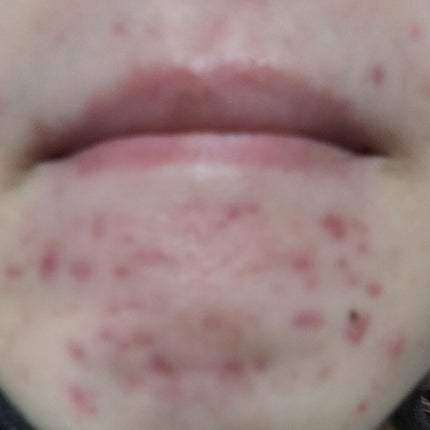 潤い化粧水/ももぷり/化粧水を使ったクチコミ(2枚目)