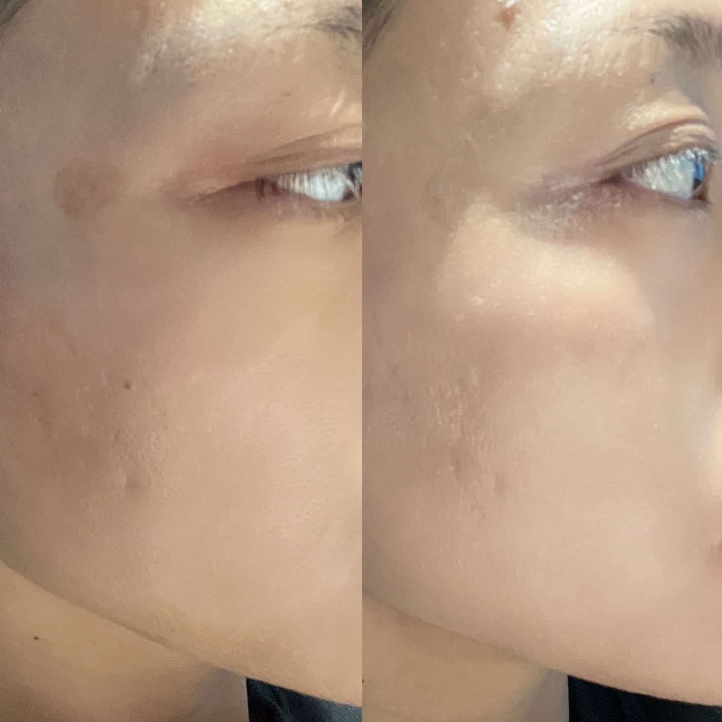 アイレノールすっぴんクリーム/IRENOL/クリームコンシーラーを使ったクチコミ(4枚目)