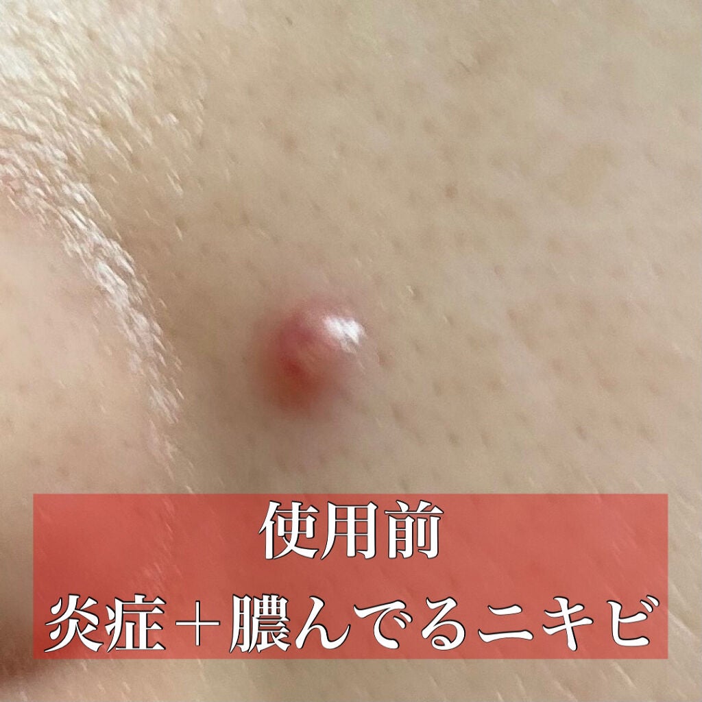 トラブルキュア/美肌ファクトリー/シートマスク・パックを使ったクチコミ(2枚目)