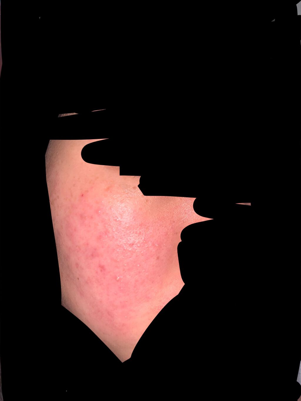 ãŠã³ð° on LIPS ãïŒåç®ã®æçš¿ãšèŠæ¯ã¹ãŠããã ãããã§ãã以åãããã²ã©ããªã£ã..ãïŒ1æç®ïŒ