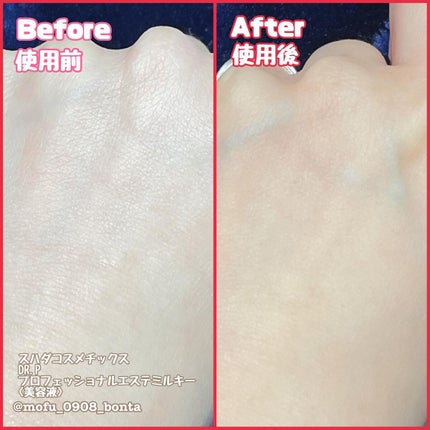 スハダDR.P プロフェッショナルエステミルキー/スハダコスメチックス/美容液を使ったクチコミ(3枚目)