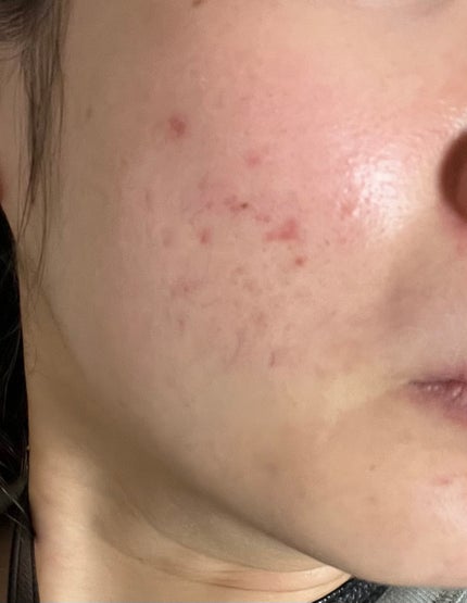 リズムコンセントレートウォーター/AYURA/化粧水を使ったクチコミ(2枚目)