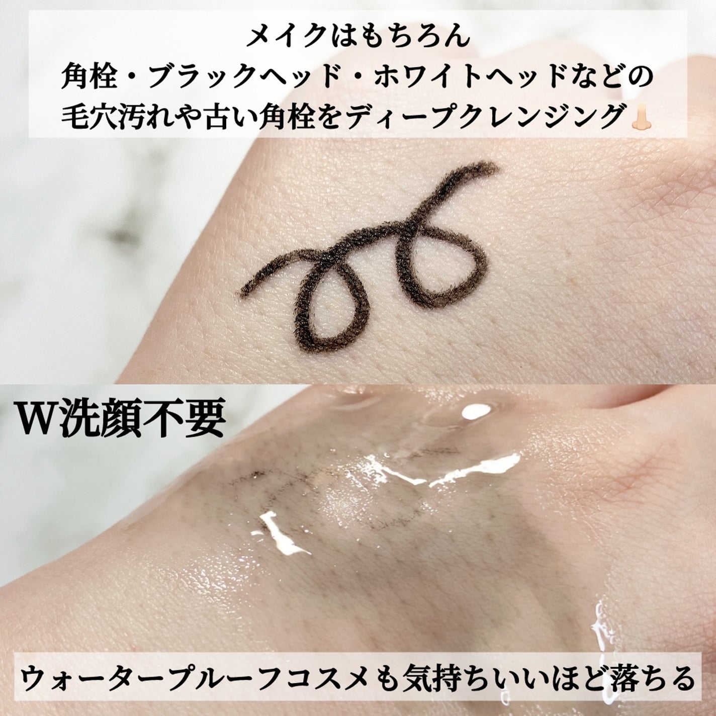 ドクダミ ポアコントロールクレンジングオイル/Anua/オイルクレンジングを使ったクチコミ(3枚目)