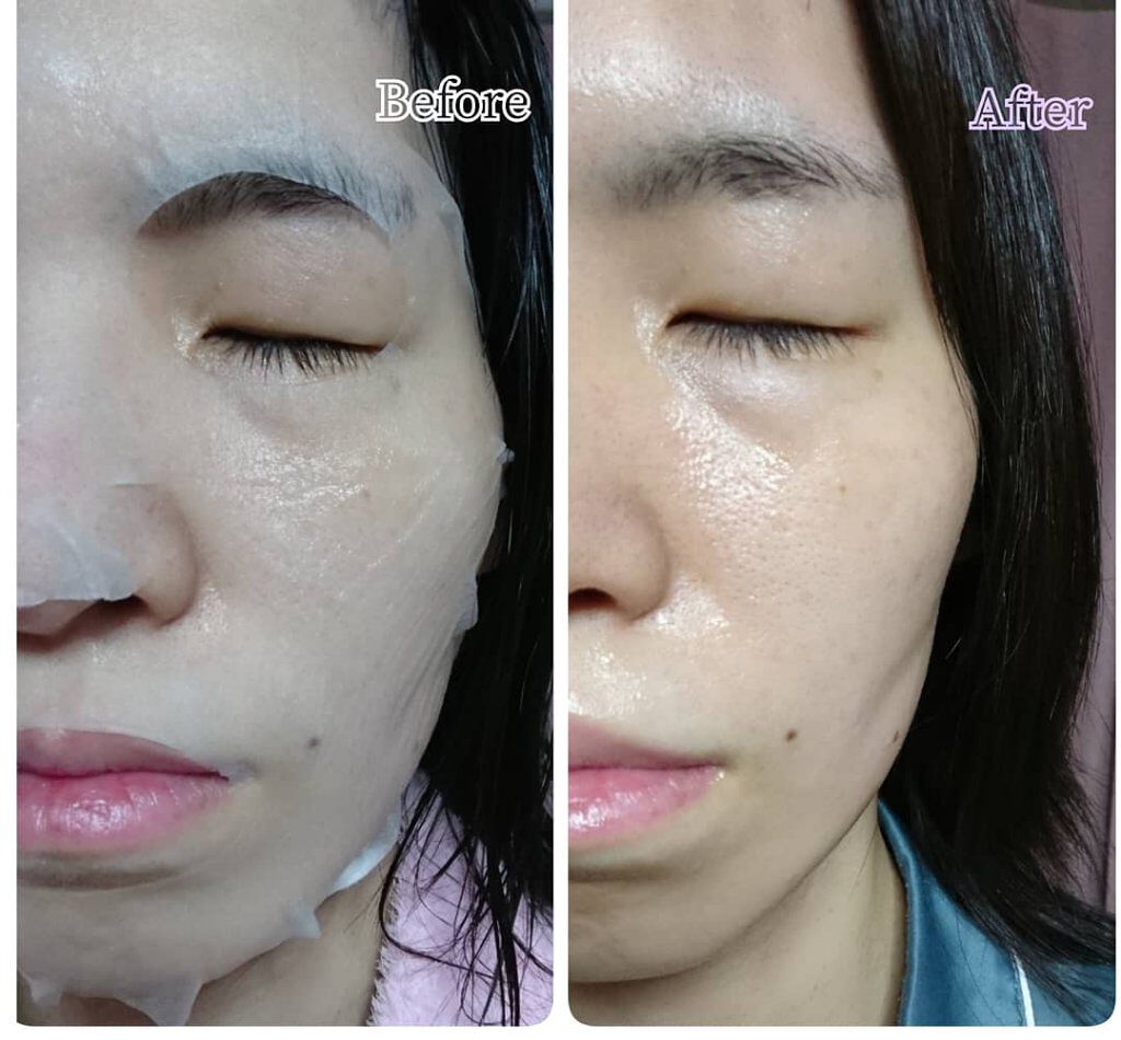 H9 ヒアルロニック アンプルマスク/JMsolution/シートマスク・パックを使ったクチコミ(8枚目)