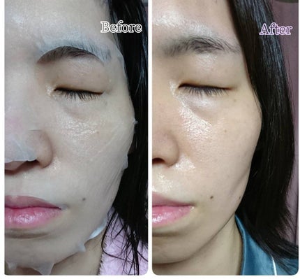 H9 ヒアルロニック アンプルマスク/JMsolution/シートマスク・パックを使ったクチコミ(8枚目)