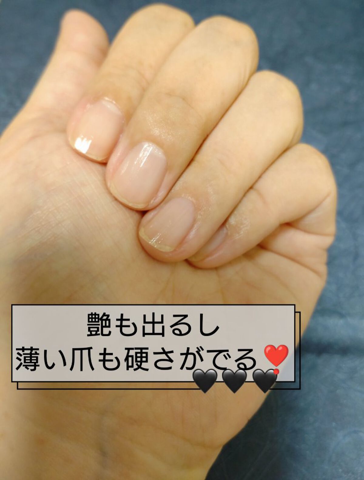 ファイバーインプロテクション/ネイリスト/オールインワンネイルを使ったクチコミ（3枚目）