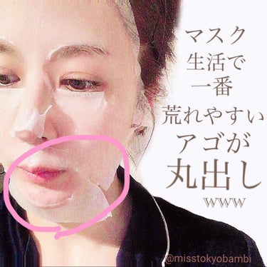 白ゆり@美容ブロガー on LIPS 「マスク生活で敏感になっている肌へと書かれたパックを買ったらマス..」（7枚目）
