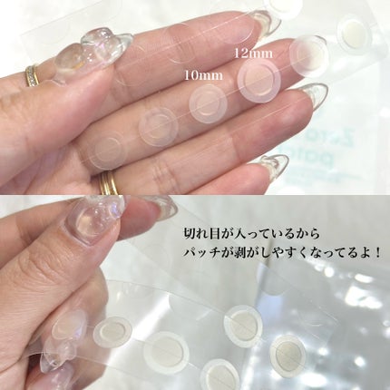 ゼロスポットパッチ/Today’s Cosme/にきびパッチを使ったクチコミ(3枚目)