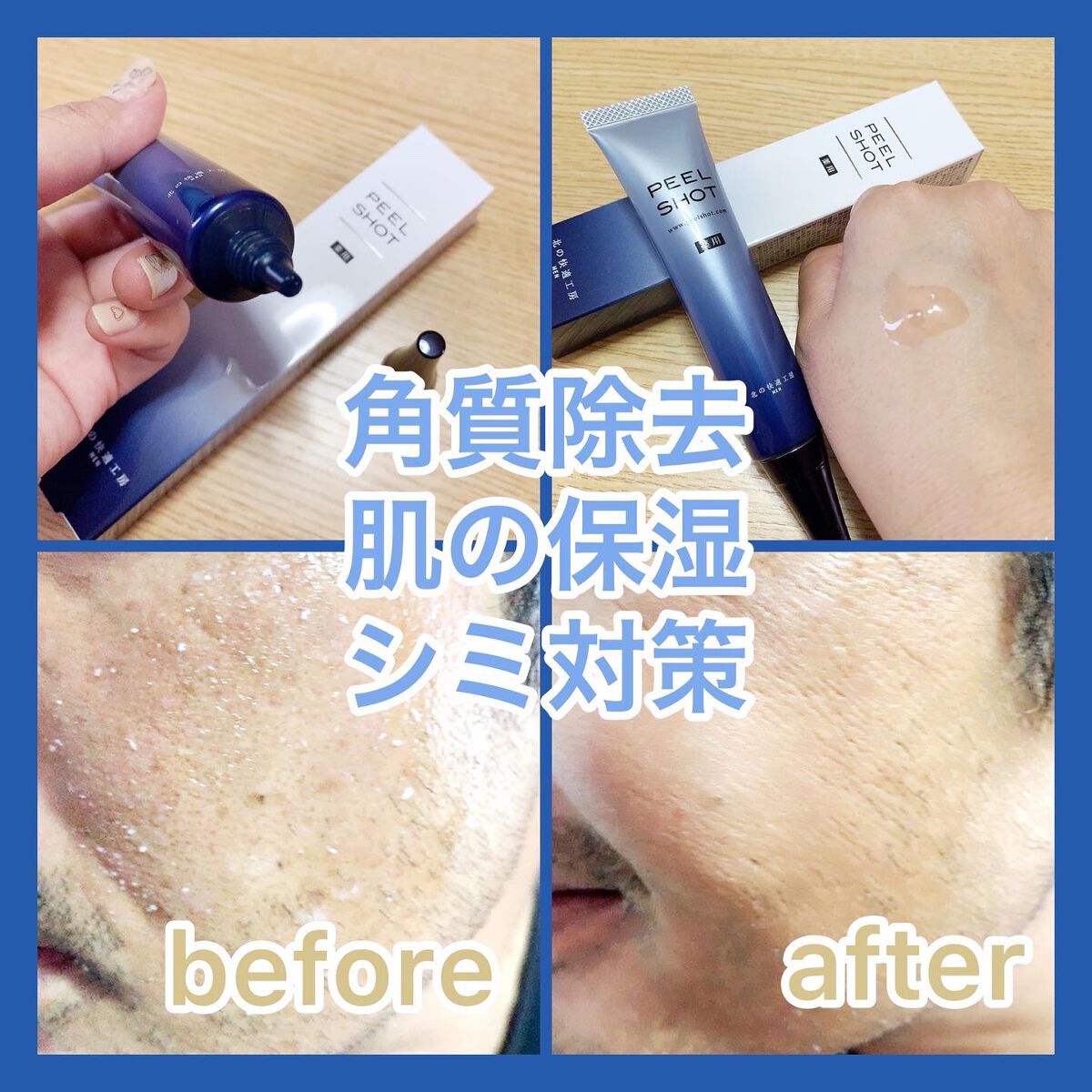 ピールショット/北の快適工房/ピーリングを使ったクチコミ(2枚目)