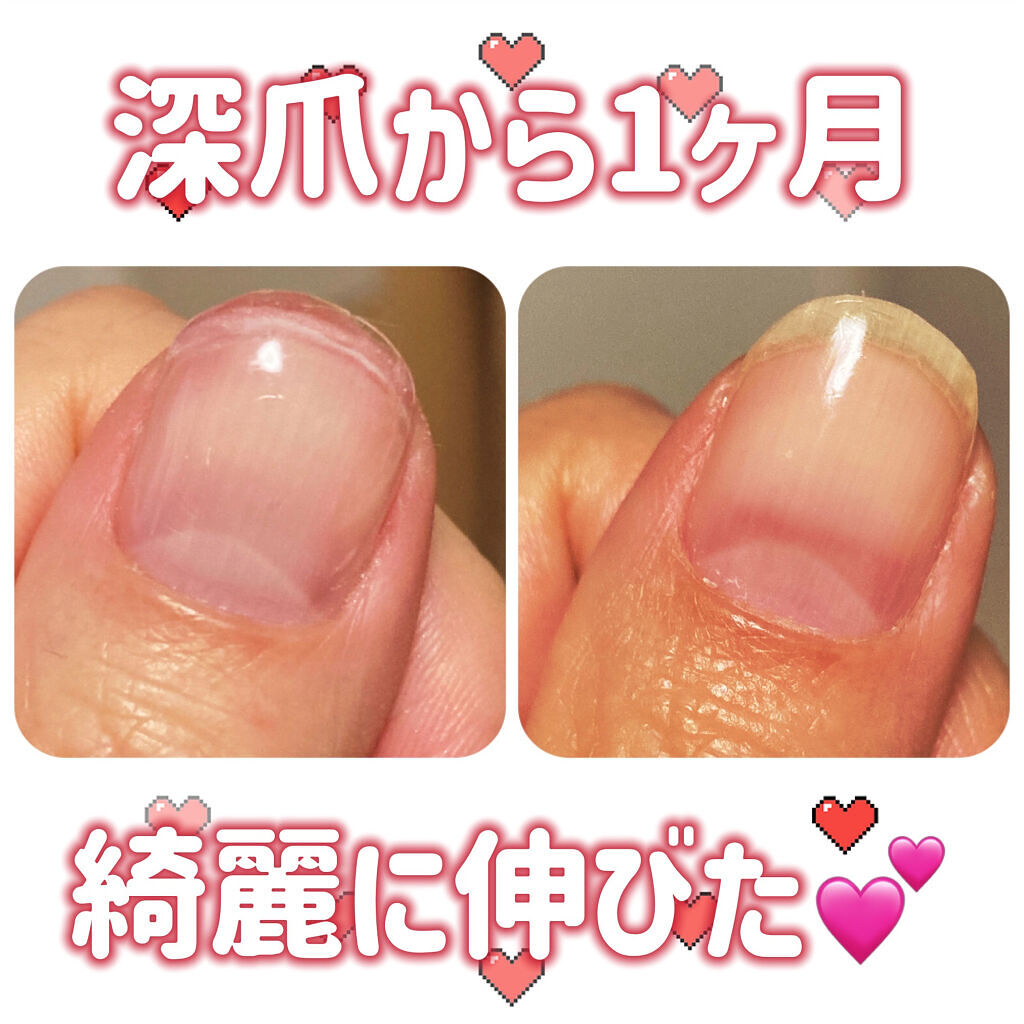 ARKEY TOKYO NONWIPE TOP #2のクチコミ「ARKEY TOKYONONWIPE TOP #2

🦑「ちょうど先月の今頃（2月11日）」
.....」（1枚目）