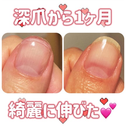 NONWIPE TOP #2/ARKEY TOKYO/ジェルネイルを使ったクチコミ(1枚目)