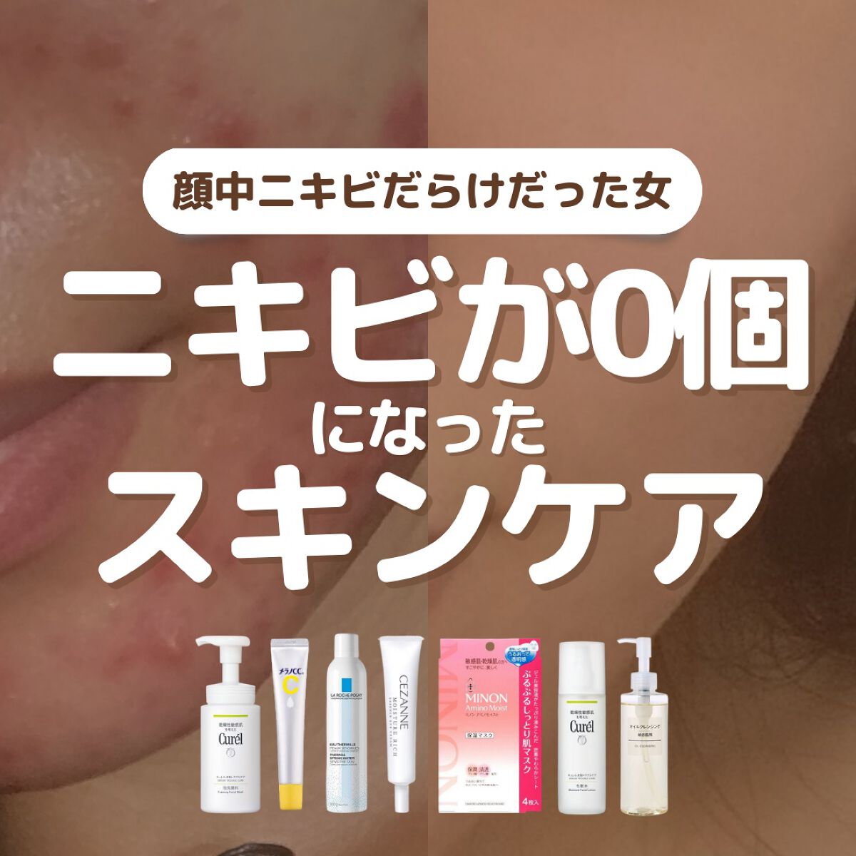 皮脂トラブルケア 化粧水/キュレル/化粧水を使ったクチコミ（1枚目）