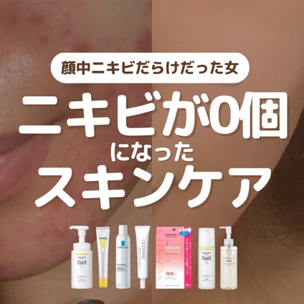 皮脂トラブルケア 化粧水/キュレル/化粧水を使ったクチコミ(1枚目)