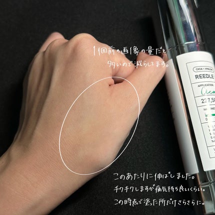 リードルショット300/VT/美容液を使ったクチコミ(4枚目)