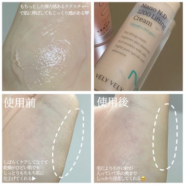 ハリ、乾燥が気になる人は絶対見てほしい🥺
VELYVELYのNano N.D 1200 Lifting Cream 🤍

毛穴より小さい針が成分を肌の奥まで届けてくれる📦
痛くないけどたまにチクチクする