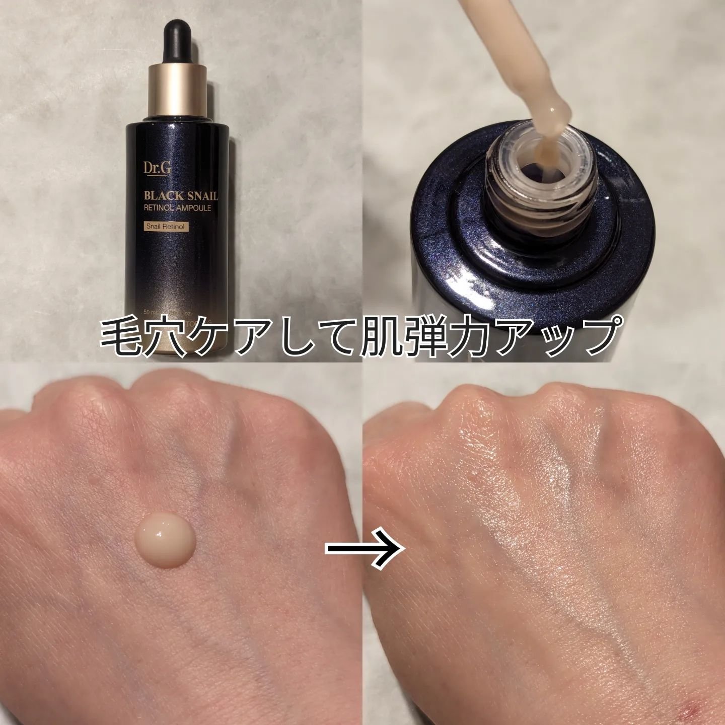 ブラックスネイルレチノールセラム/Dr.G/美容液を使ったクチコミ（2枚目）