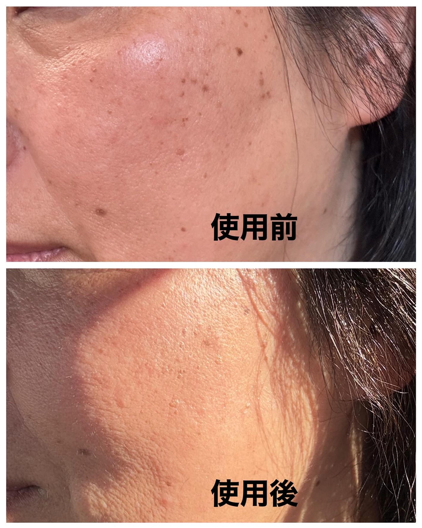 アイレノール クマクリーム/IRENOL/アイケア・アイクリームを使ったクチコミ(8枚目)