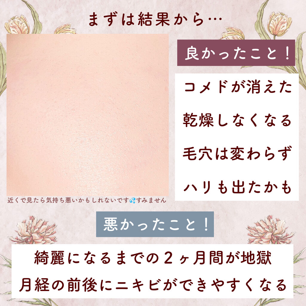 サンホワイトP-1/サンホワイト/ボディクリームを使ったクチコミ（2枚目）