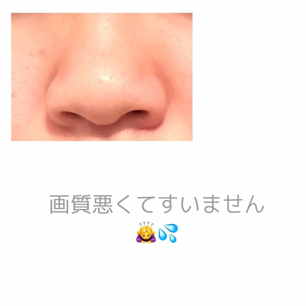 極潤 ヒアルロン液(旧)/肌ラボ/化粧水を使ったクチコミ(2枚目)