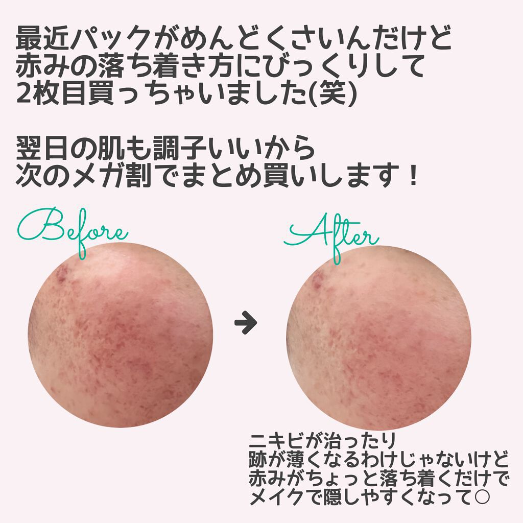 弱酸性pHシートマスク ドクダミフィット/Abib /シートマスク・パックを使ったクチコミ(3枚目)