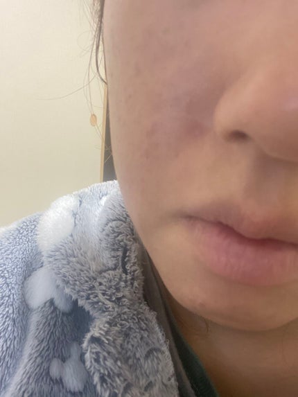 カバーパーフェクション チップコンシーラー/the SAEM/リキッドコンシーラーを使ったクチコミ(2枚目)